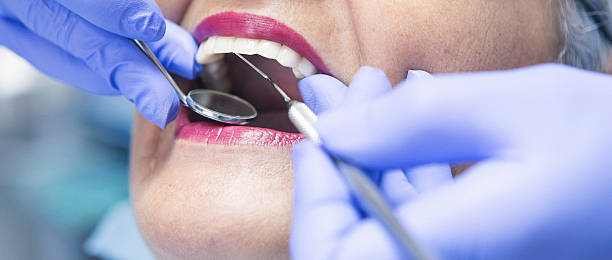 Best Emergency Broken Tooth Repair in Fort Mckinley, OH